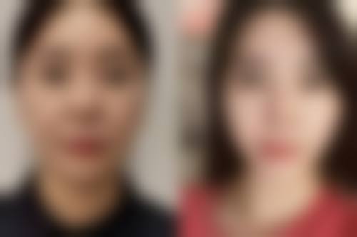 杭州水臻柏妍整形医院怎么样来院路线