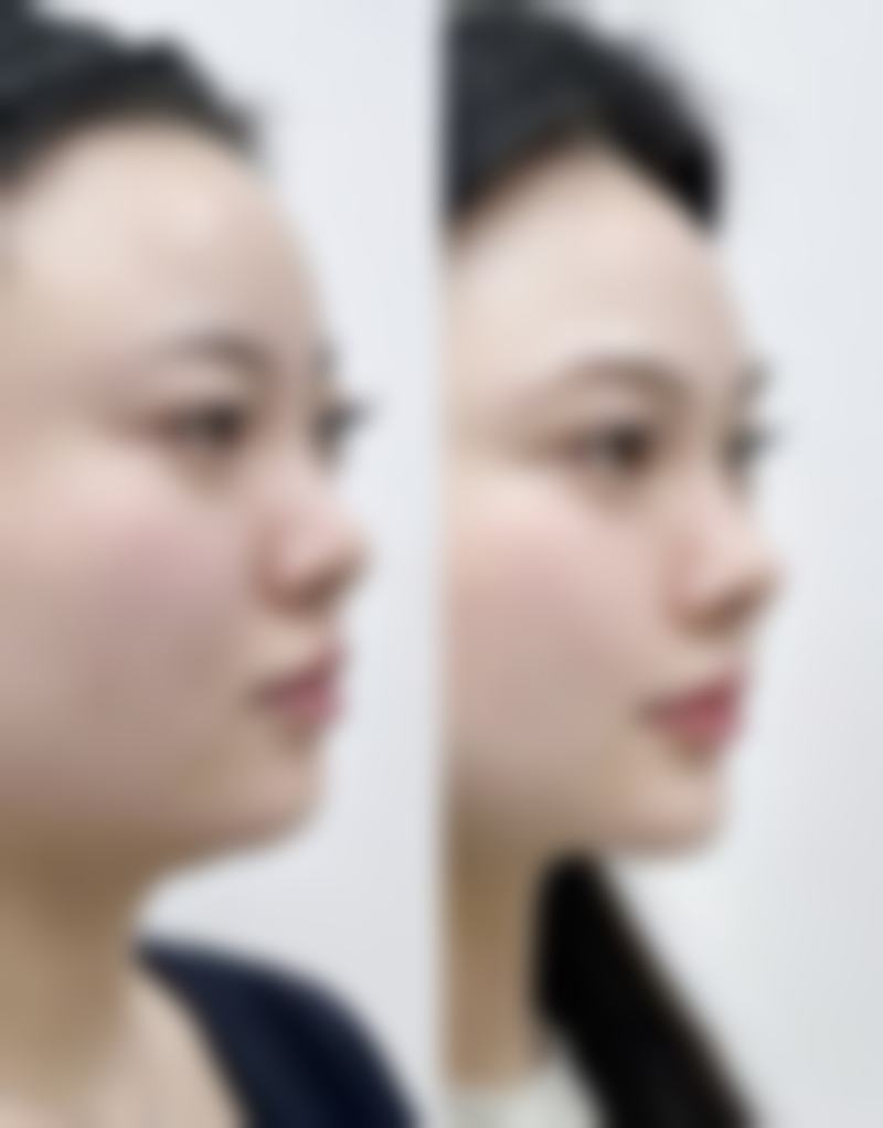 鞍山英威医疗美容门诊部怎么样求美者反馈