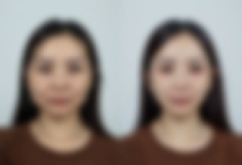 鞍山英威医疗美容门诊部怎么样特色项目及技术优势