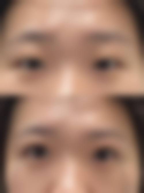 昆明喻青医疗美容诊所怎么样价格收费