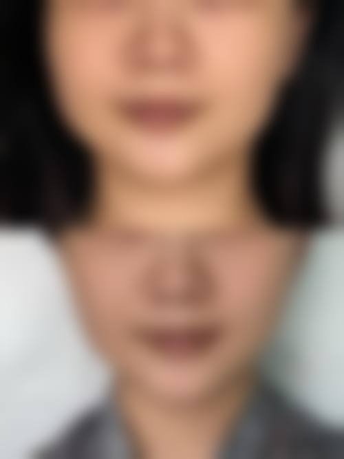 青岛千美汇医疗美容门诊部怎么样来院路线