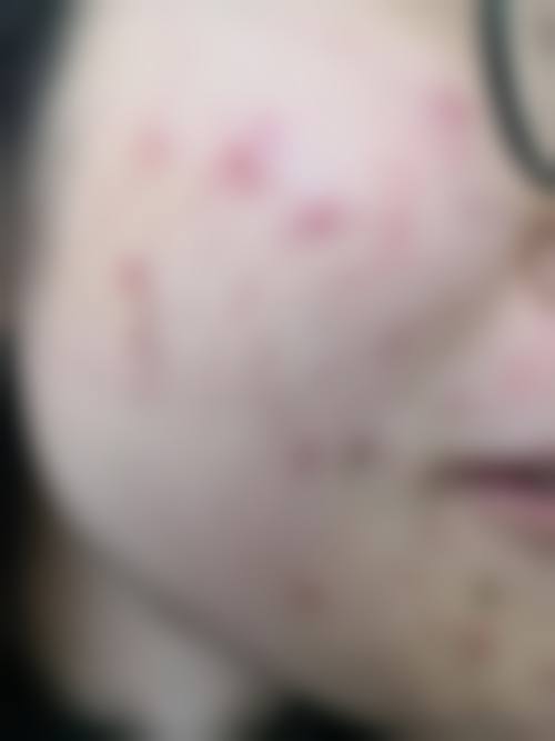 铁岭首大皮肤病医院怎么样价格收费