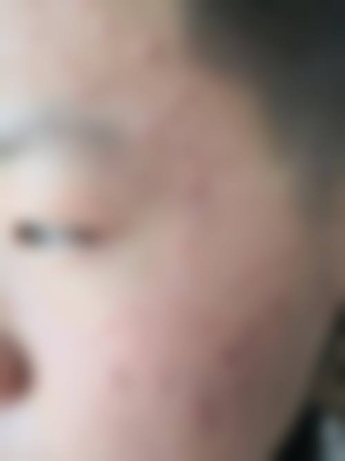 铁岭首大皮肤病医院怎么样求美者反馈