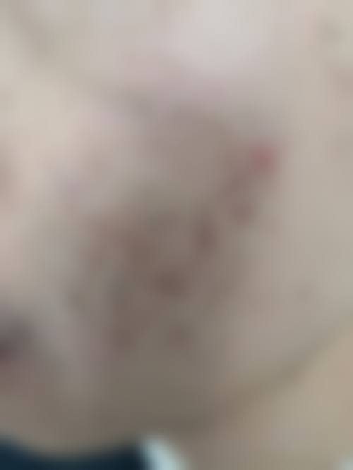 铁岭首大皮肤病医院怎么样简介概述