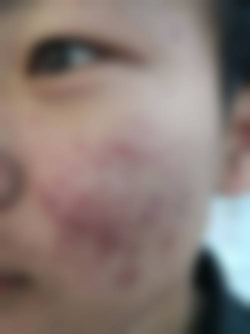 铁岭首大皮肤病医院怎么样医生团队实力