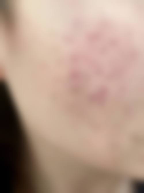 铁岭首大皮肤病医院怎么样来院路线