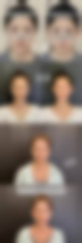 昆明昕雨整形美容诊所怎么样求美者反馈