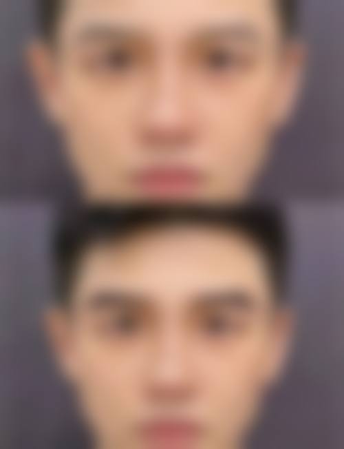 长沙常德岳阳郴州合肥笙泽植发怎么样医生团队实力