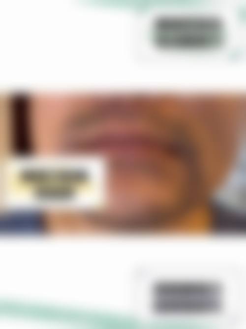 长沙常德岳阳郴州合肥笙泽植发怎么样来院路线