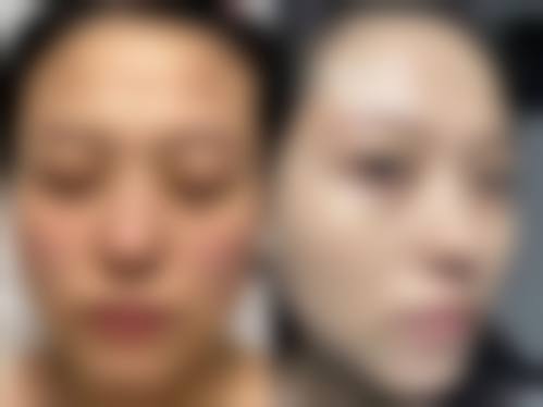 昆明昕雨整形美容诊所怎么样医生团队实力