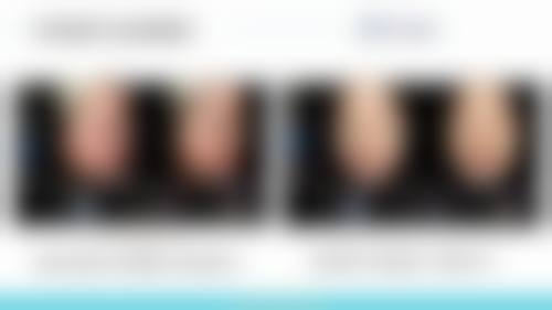 昆明喻青医疗美容诊所怎么样求美者反馈