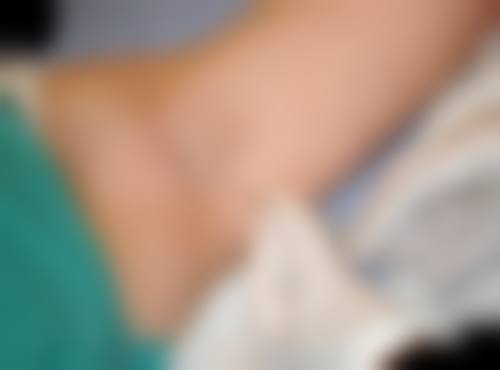 大同美神整形美容诊所怎么样价格收费