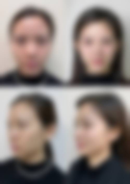 Rize Clinic福冈天神怎么样求美者反馈