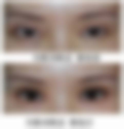 宁夏银川慧清雅妍医疗美容门诊部怎么样特色项目及技术优势