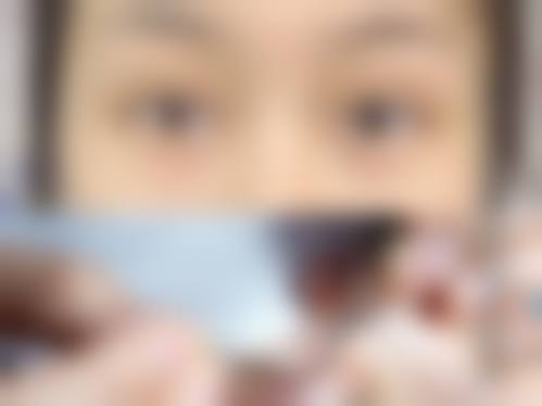 宁夏银川慧清雅妍医疗美容门诊部怎么样求美者反馈