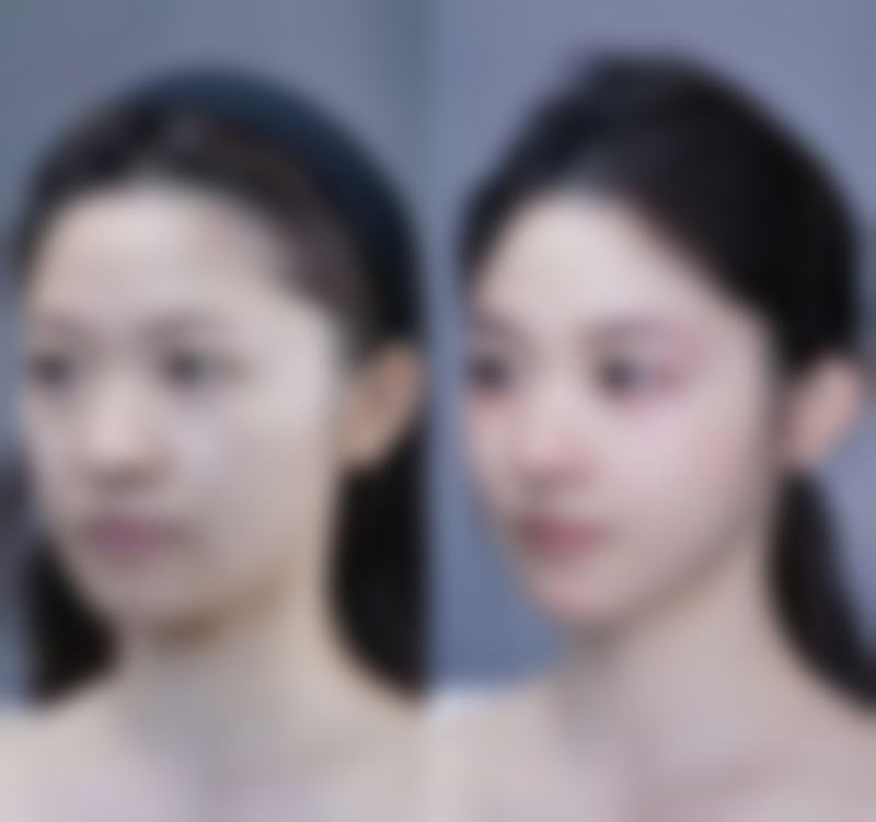 北京世熙整形美容门诊部怎么样求美者反馈