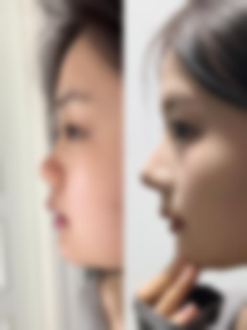 河北衡水惟美整形医疗美容怎么样求美者反馈