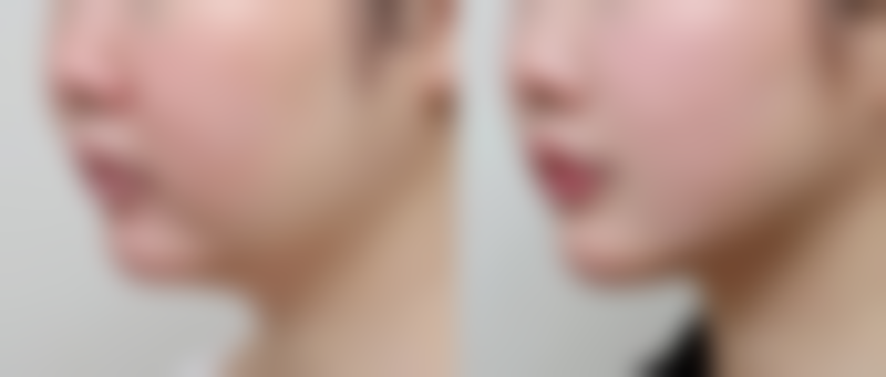 成都沐兮华颜医疗美容诊所怎么样来院路线