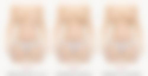 大连何医生鼻整形门诊怎么样价格收费