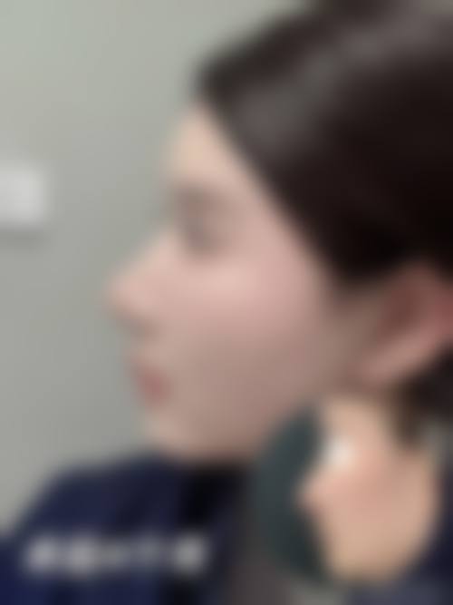 重庆沙坪坝唯尔美整形医院怎么样价格收费