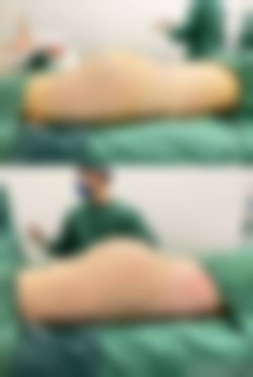 张家港市第一人民医院(烧伤整形科)怎么样价格收费