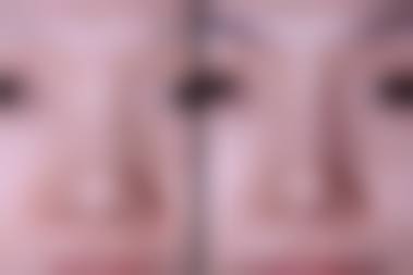 南昌亚太医疗美容怎么样医生团队实力