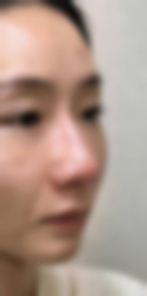 淮安素一整形医院怎么样价格收费