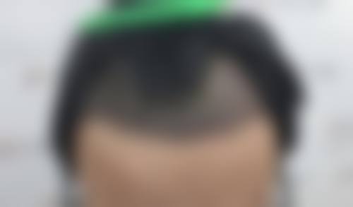 贵阳一艺美医疗美容诊所怎么样医生团队实力