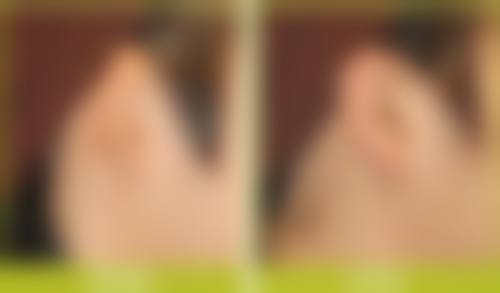 长春康弘医院整形外科（原铭仁医院）怎么样价格收费