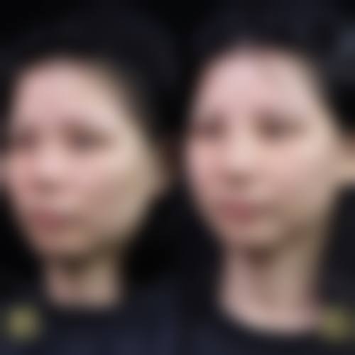 贺州市人民医院(创面修复烧伤整形外科)怎么样特色项目及技术优势