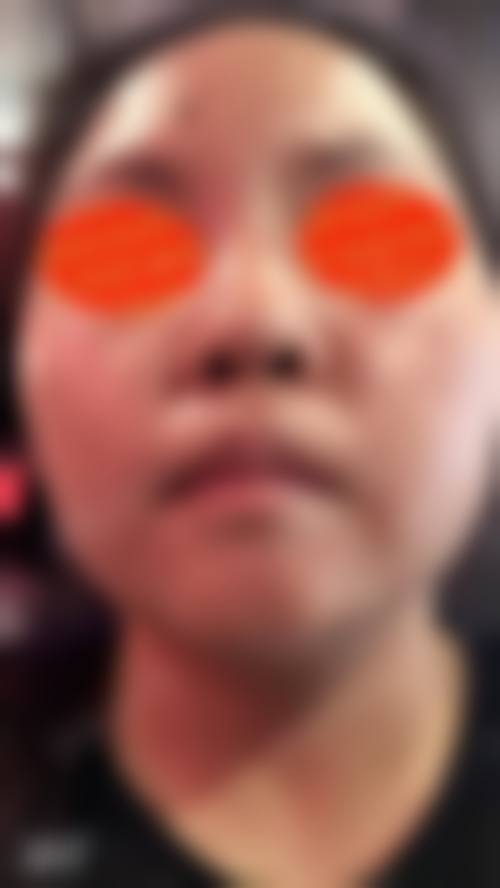 张家港市第一人民医院(烧伤整形科)怎么样特色项目及技术优势