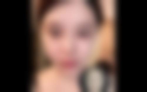 深圳金嬉微创整形医院怎么样价格收费