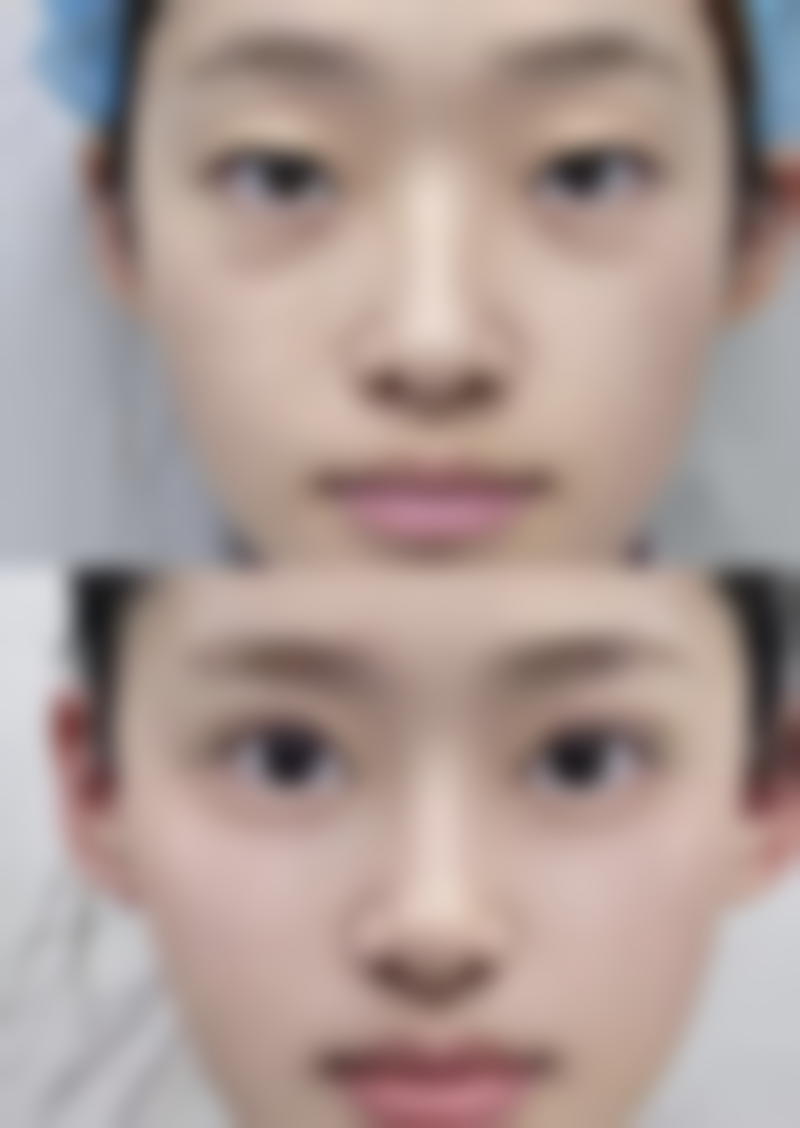 大连何医生鼻整形门诊怎么样简介概述