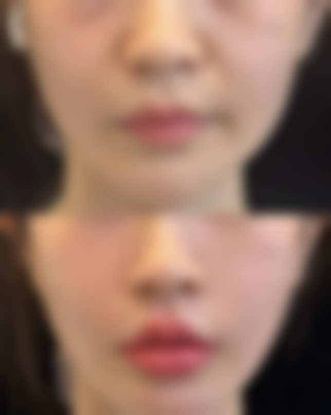 重庆晶肤医学美容医院怎么样求美者反馈