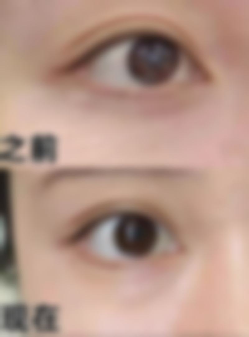 杭州青琴怡美医疗美容诊所怎么样价格收费