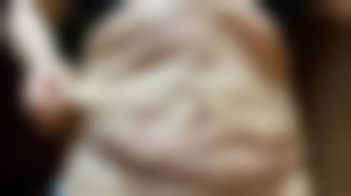 北京儿童医院怎么样求美者反馈