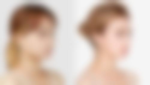 鞍山王静峙医疗美容诊所怎么样求美者反馈