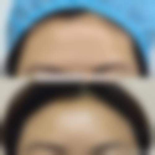 岳阳市中医院整形美容科怎么样特色项目及技术优势