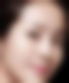 岳阳市中医院整形美容科怎么样医生团队实力