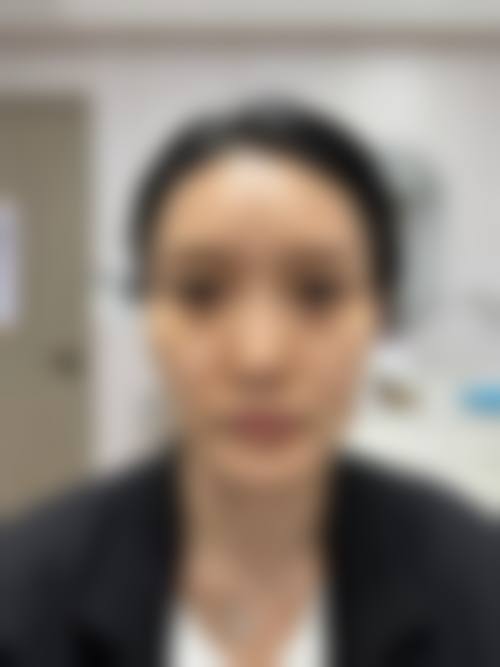 扬州广陵黄婵医疗美容整形医院怎么样求美者反馈