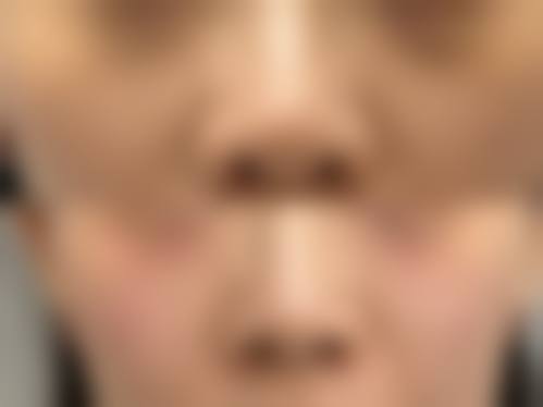 扬州广陵黄婵医疗美容整形医院怎么样来院路线