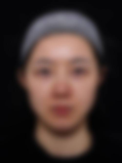 荣成星汇整形医院怎么样价格收费