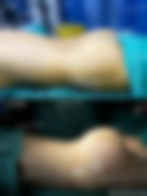 曾明医生：值得信赖的医美选择