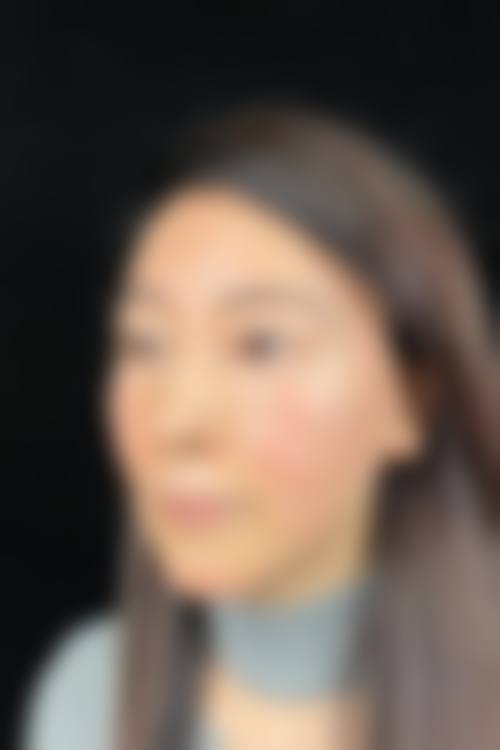 岳阳市中医院整形美容科怎么样价格收费