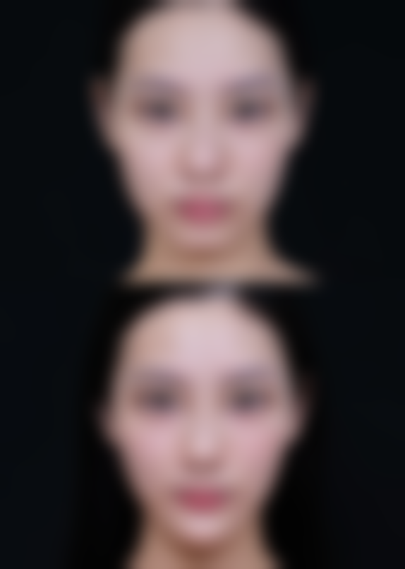 淮南韩一丽整形医院怎么样来院路线