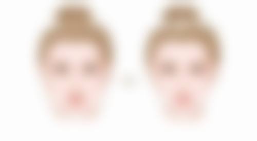 曾明医生的临床经验