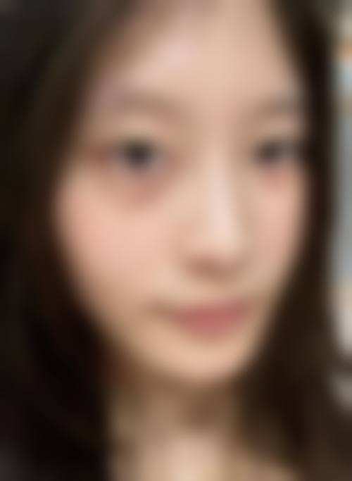 沈阳李梅整形医疗美容诊所怎么样特色项目及技术优势