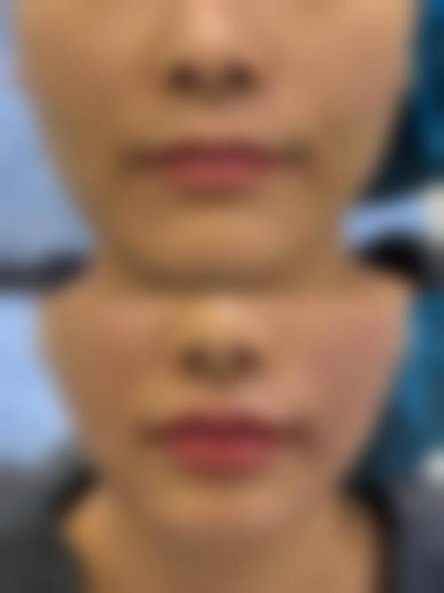 日照仁爱医院医疗美容科怎么样来院路线