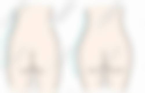 本溪王晓明整形医疗美容门诊怎么样来院路线