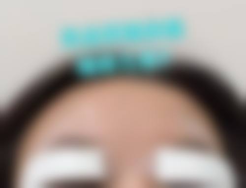 台州医院烧伤整形科怎么样价格收费